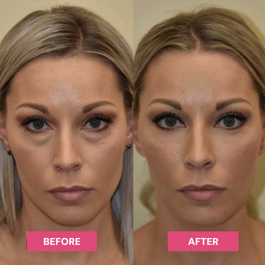 Luxe - Korean Under-Eye Balm Luxe Research