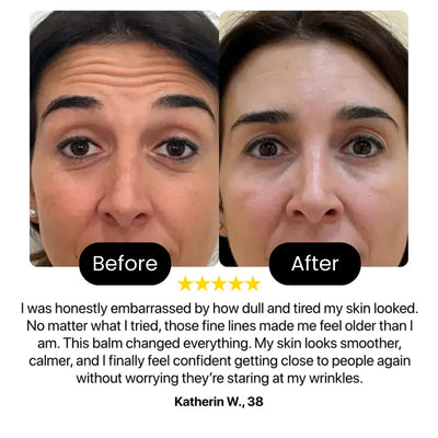 Luxe - Korean Eye Bag Eraser Balm Luxe Research